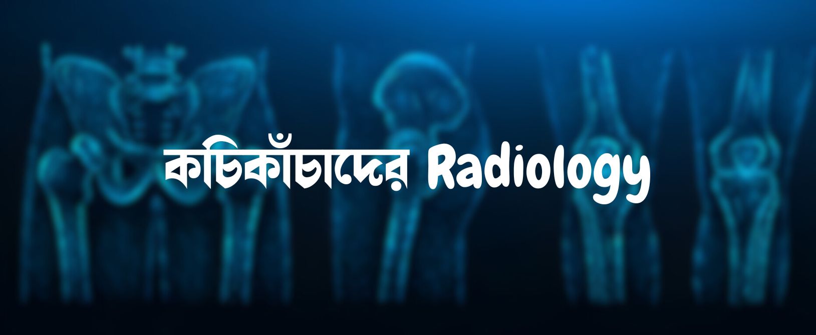 কচিকাঁচাদের Radiology: for 1st prof!!!